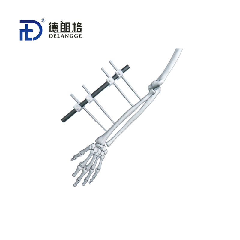 桡骨组合式外固定架