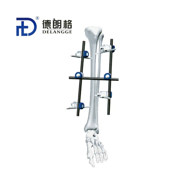 胫骨组合式外固定架-I