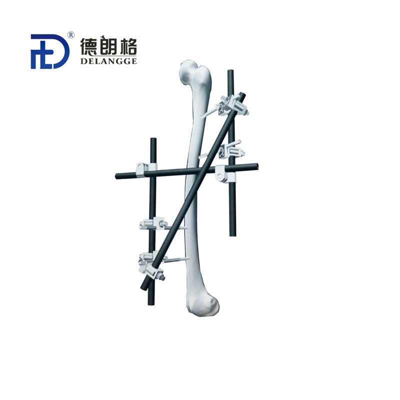 股骨组合式外固定架-IV