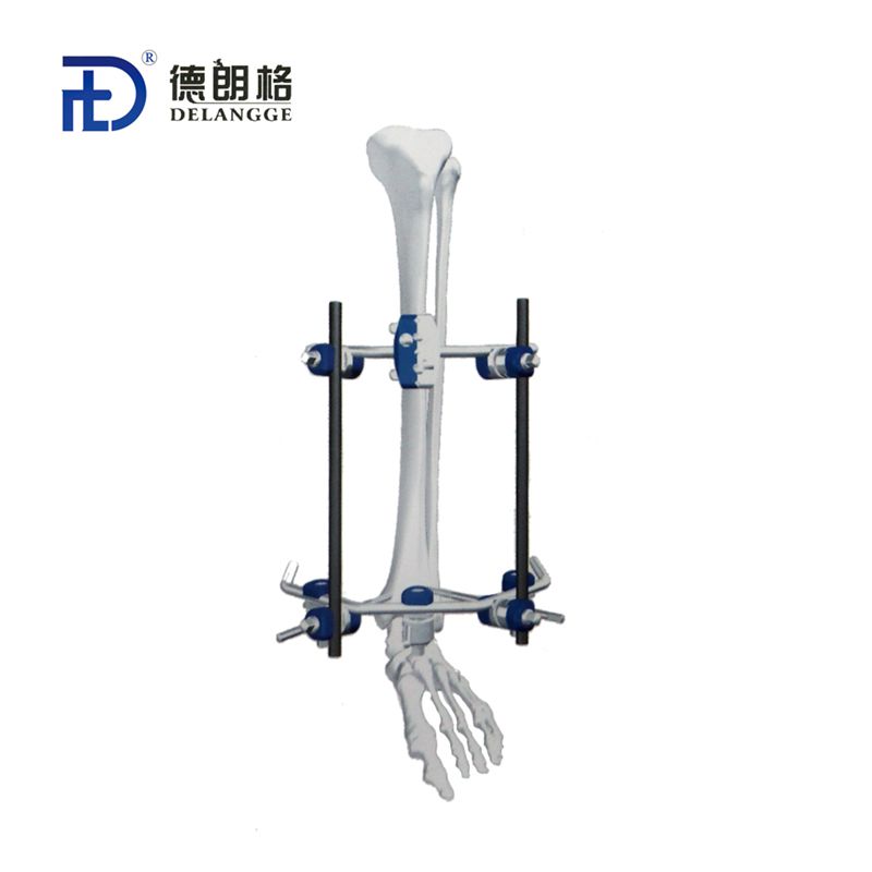 胫骨远端组合式外固定架