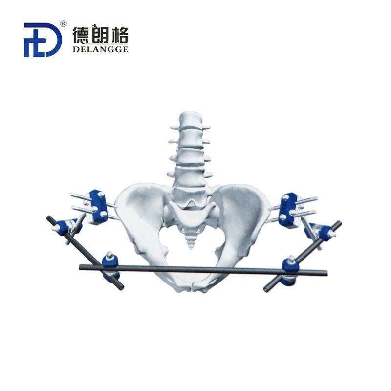 骨盆框架组合式外固定架