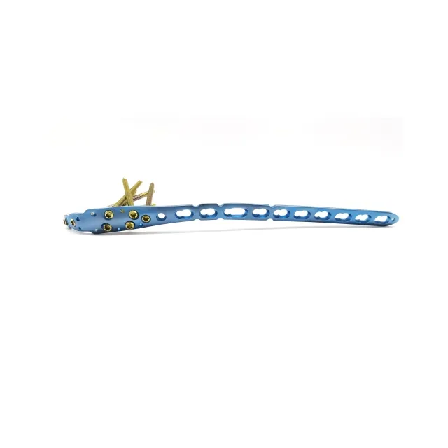 Olecranon Locking Plate